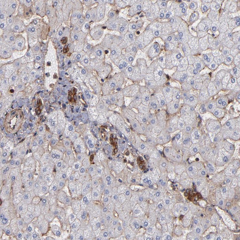Atlas Antibodies Anti-ACTN4 Antibody