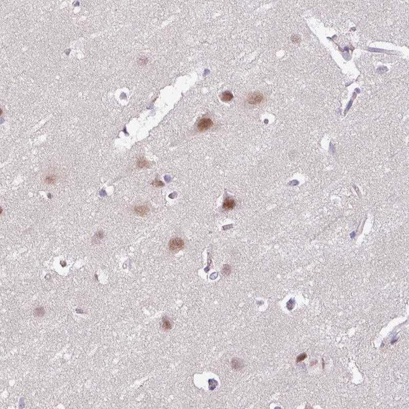 Atlas Antibodies Anti-ACTR3 Antibody