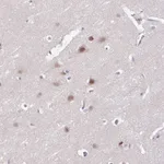 Atlas Antibodies Anti-ACTR3 Antibody