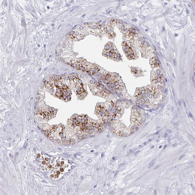 Atlas Antibodies Anti-ACTR3C Antibody