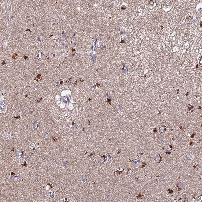 Atlas Antibodies Anti-ACTR5 Antibody