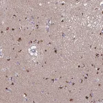 Atlas Antibodies Anti-ACTR5 Antibody
