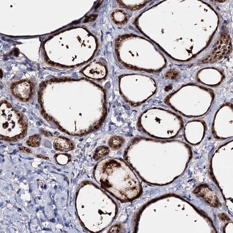 Atlas Antibodies Anti-ACTR6 Antibody