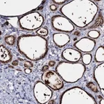 Atlas Antibodies Anti-ACTR6 Antibody