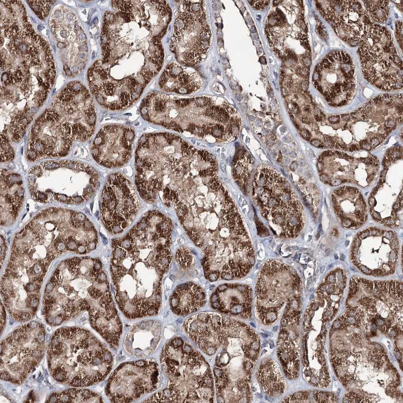 Atlas Antibodies Anti-ACTR6 Antibody
