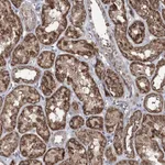 Atlas Antibodies Anti-ACTR6 Antibody