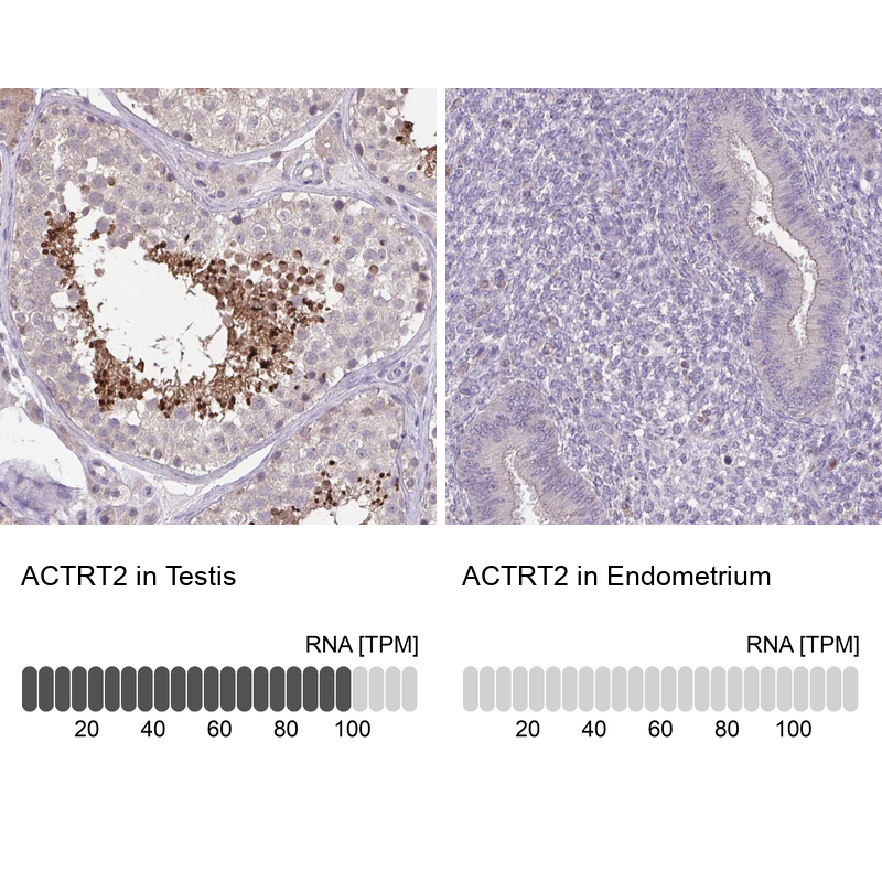 Atlas Antibodies Anti-ACTRT2 Antibody