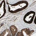 Atlas Antibodies Anti-ACVR1C Antibody