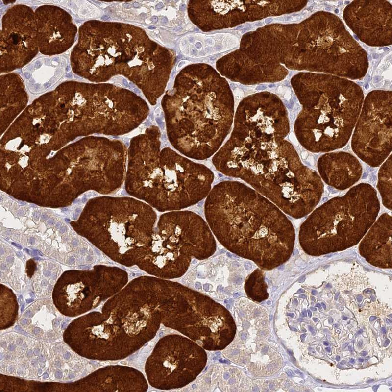 Atlas Antibodies Anti-ACY1 Antibody