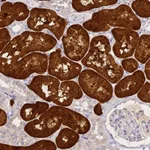 Atlas Antibodies Anti-ACY1 Antibody
