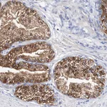 Atlas Antibodies Anti-ACVR1C Antibody