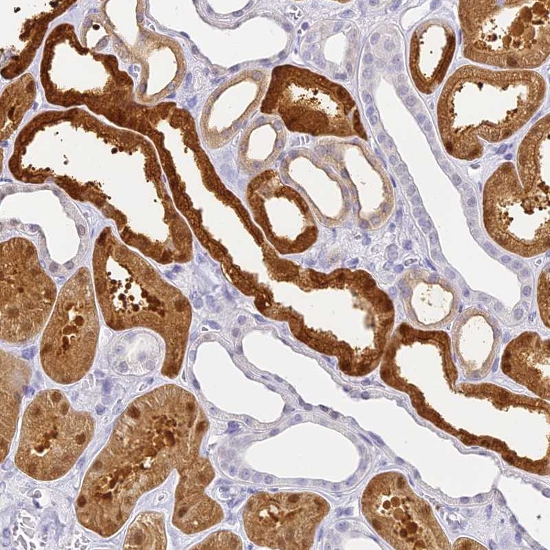 Atlas Antibodies Anti-ACY1 Antibody