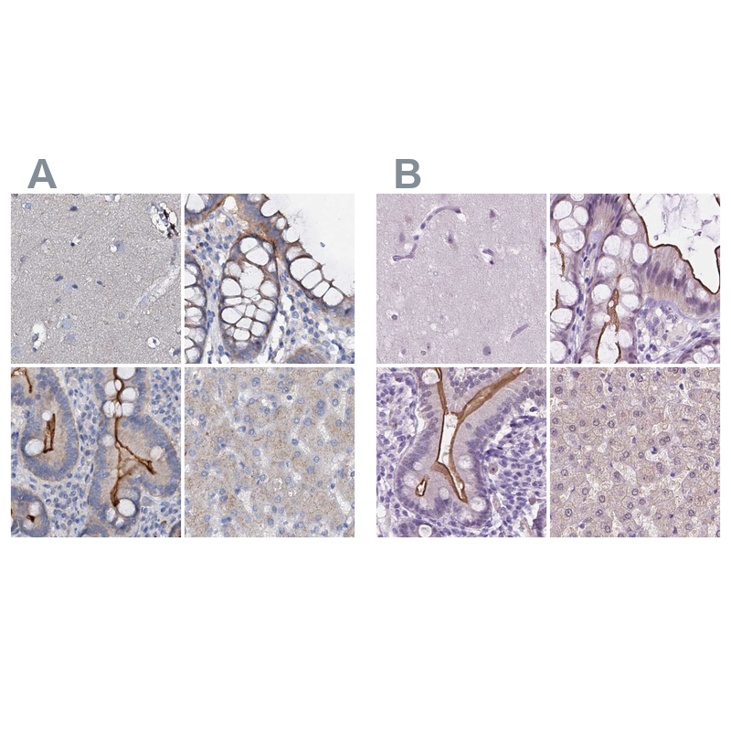 Atlas Antibodies Anti-ACY3 Antibody