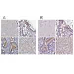 Atlas Antibodies Anti-ACY3 Antibody
