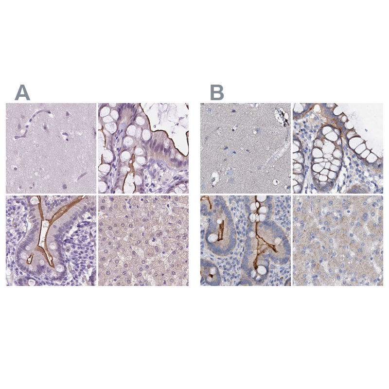 Atlas Antibodies Anti-ACY3 Antibody