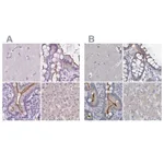 Atlas Antibodies Anti-ACY3 Antibody
