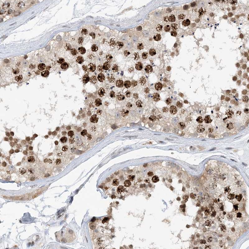 Atlas Antibodies Anti-ACYP2 Antibody