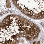 Atlas Antibodies Anti-ACYP1 Antibody