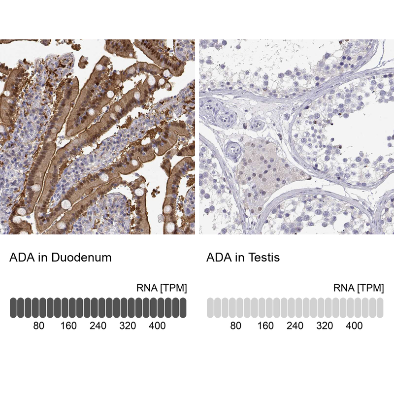 Atlas Antibodies Anti-ADA Antibody
