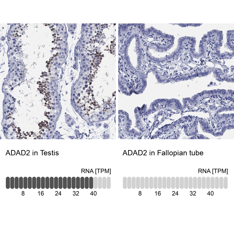 Atlas Antibodies Anti-ADAD2 Antibody