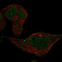 Atlas Antibodies Anti-ADAL Antibody