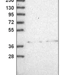 Atlas Antibodies Anti-ADAL Antibody