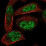 Atlas Antibodies Anti-ADAL Antibody