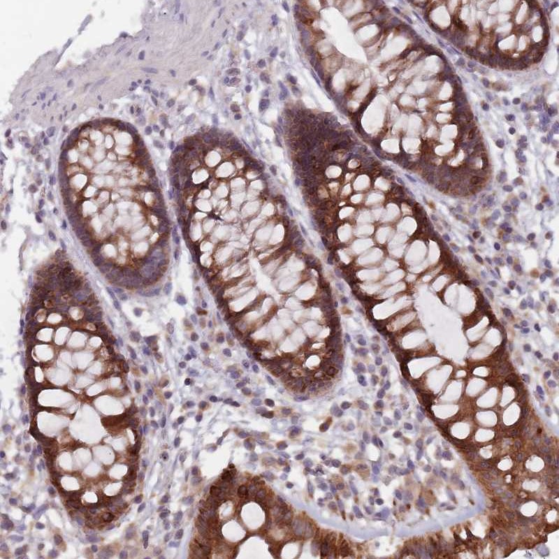 Atlas Antibodies Anti-ADAL Antibody