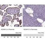 Atlas Antibodies Anti-ADAM12 Antibody