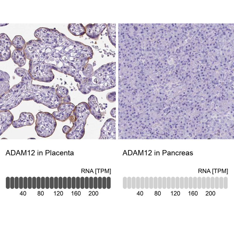 Atlas Antibodies Anti-ADAM12 Antibody