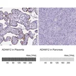 Atlas Antibodies Anti-ADAM12 Antibody