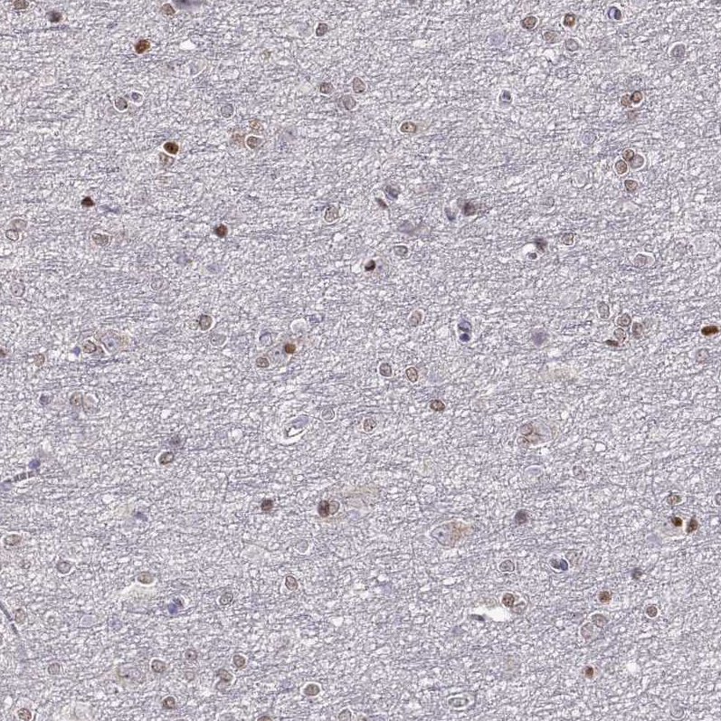 Atlas Antibodies Anti-ADAM11 Antibody