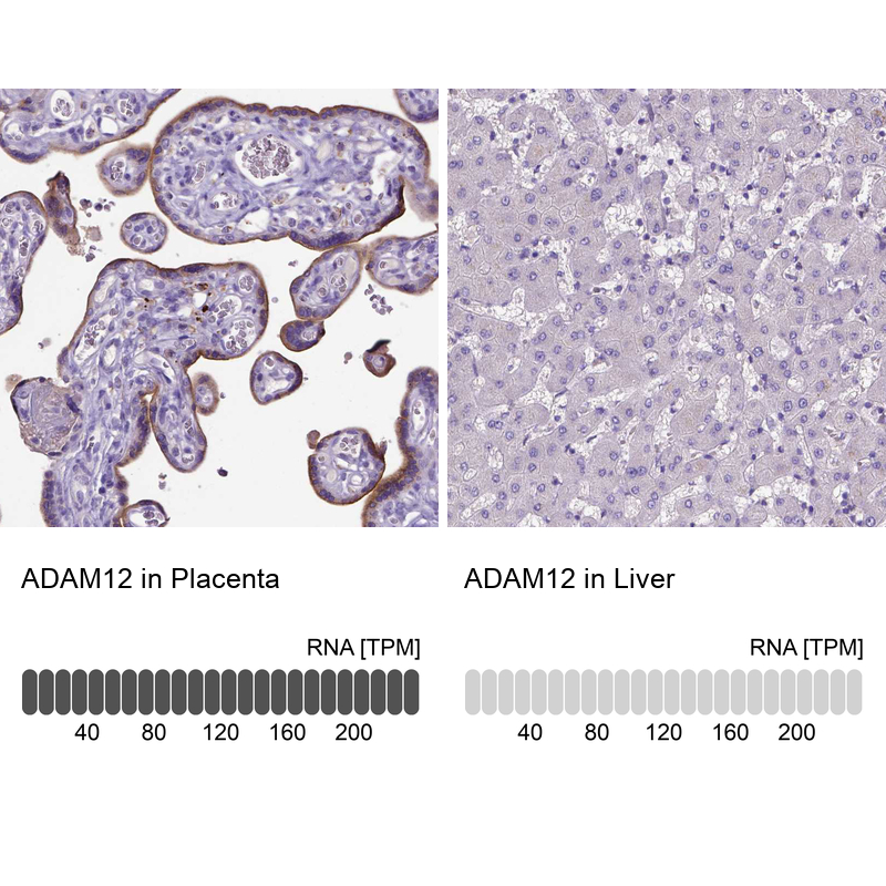 Atlas Antibodies Anti-ADAM12 Antibody