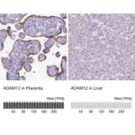 Atlas Antibodies Anti-ADAM12 Antibody