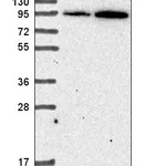 Atlas Antibodies Anti-ADAM17 Antibody