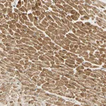 Atlas Antibodies Anti-ADAM17 Antibody