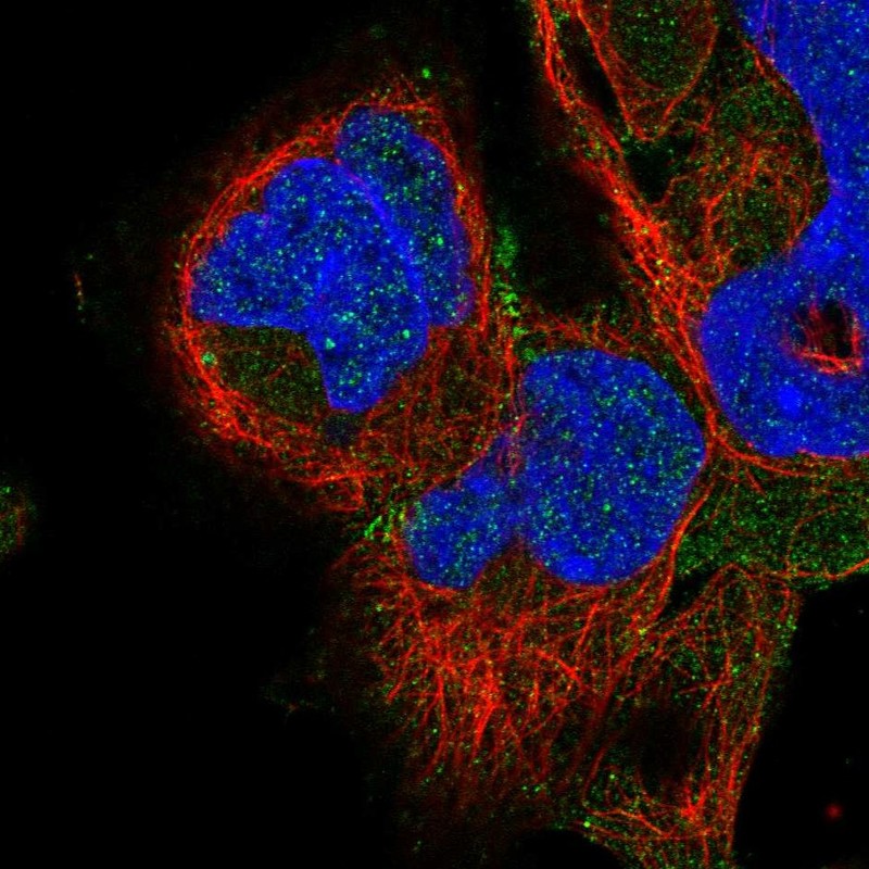 Atlas Antibodies Anti-ADAM22 Antibody