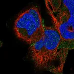 Atlas Antibodies Anti-ADAM22 Antibody