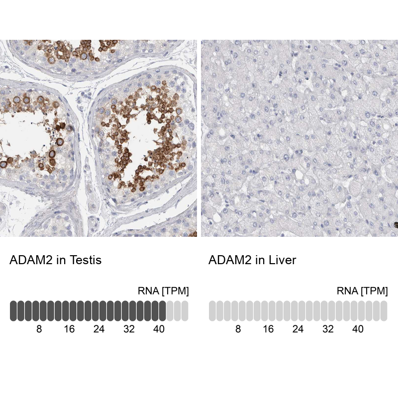 Atlas Antibodies Anti-ADAM2 Antibody