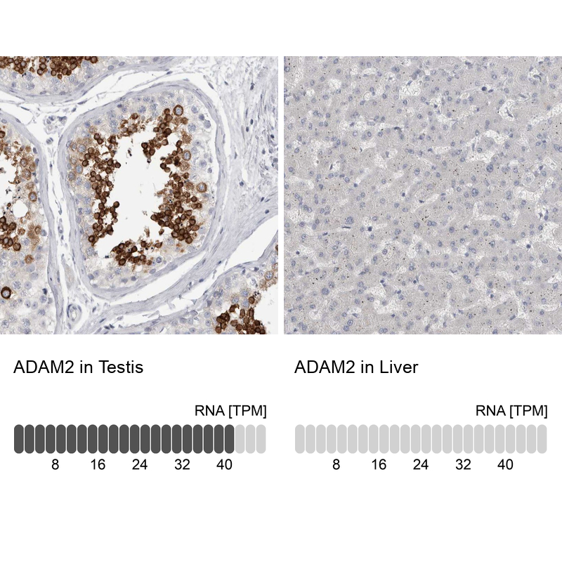 Atlas Antibodies Anti-ADAM2 Antibody