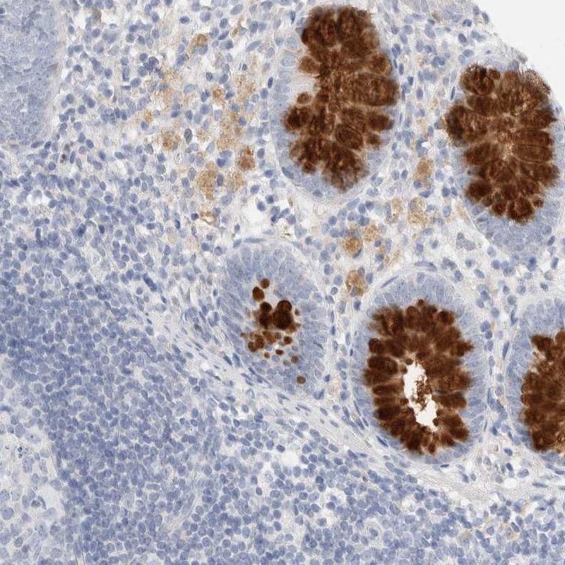 Atlas Antibodies Anti-ADAM30 Antibody