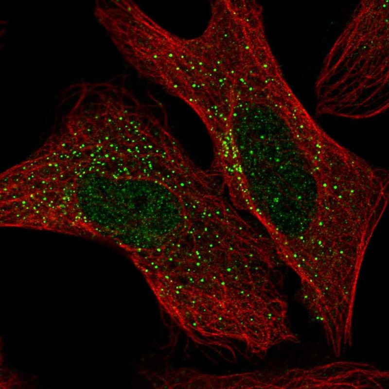 Atlas Antibodies Anti-ADAM32 Antibody