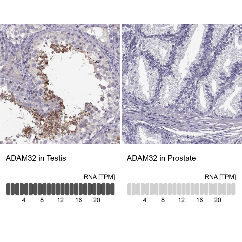 Atlas Antibodies Anti-ADAM32 Antibody