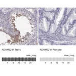 Atlas Antibodies Anti-ADAM32 Antibody