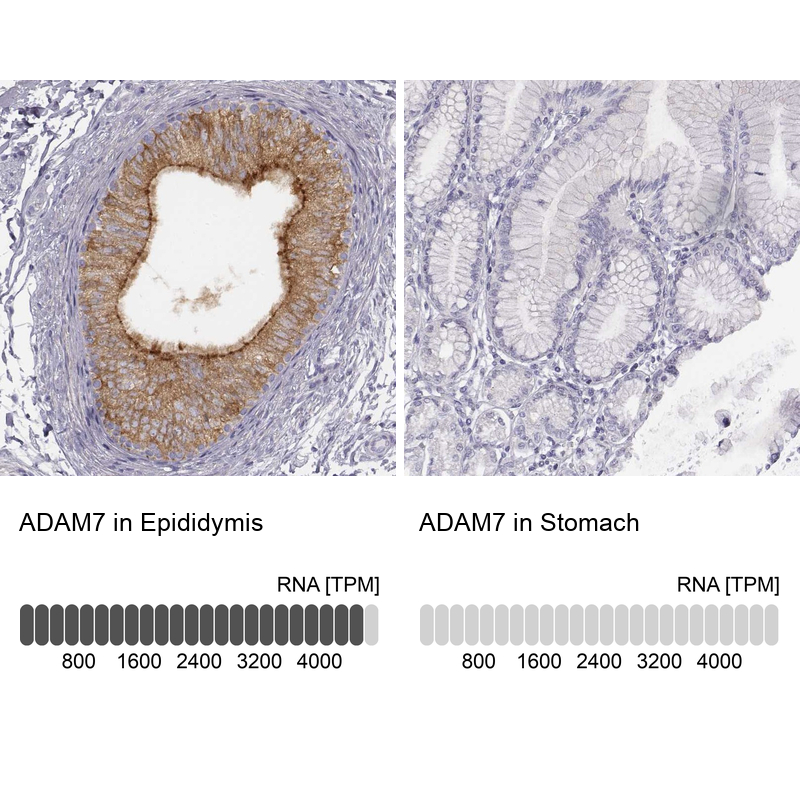 Atlas Antibodies Anti-ADAM7 Antibody