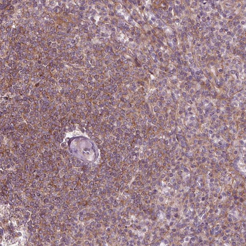 Atlas Antibodies Anti-ADAM33 Antibody