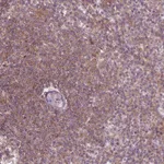 Atlas Antibodies Anti-ADAM33 Antibody