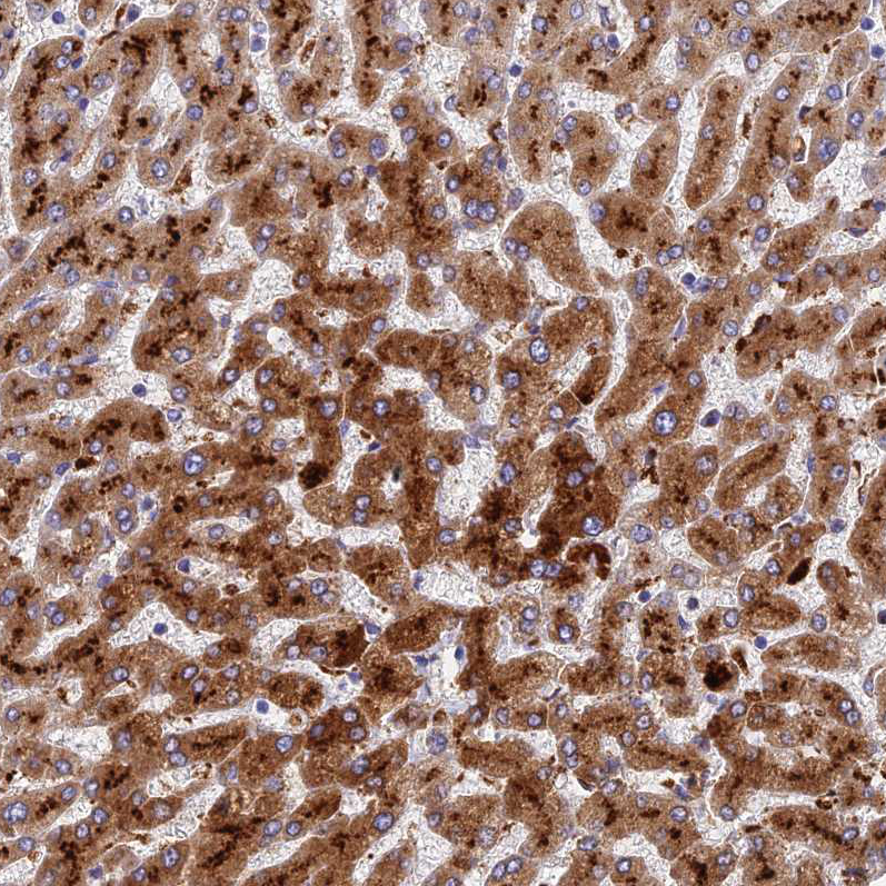 Atlas Antibodies Anti-ADAMTS13 Antibody