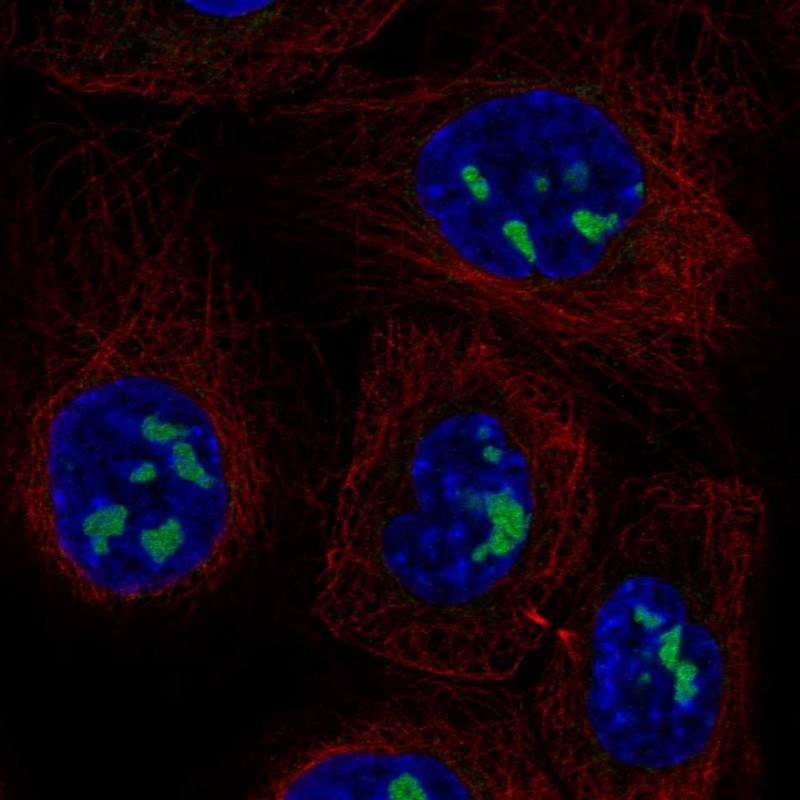 Atlas Antibodies Anti-ADAMTS12 Antibody