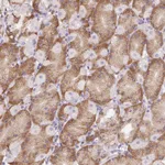 Atlas Antibodies Anti-ADAM8 Antibody